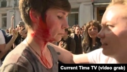 Moscow's Khamovniki District Council member from A Just Russia party Aleksandra Parushina being treated after OMON riot police hit het on her head with a baton during an election protest in Moscow on July 27, 2019