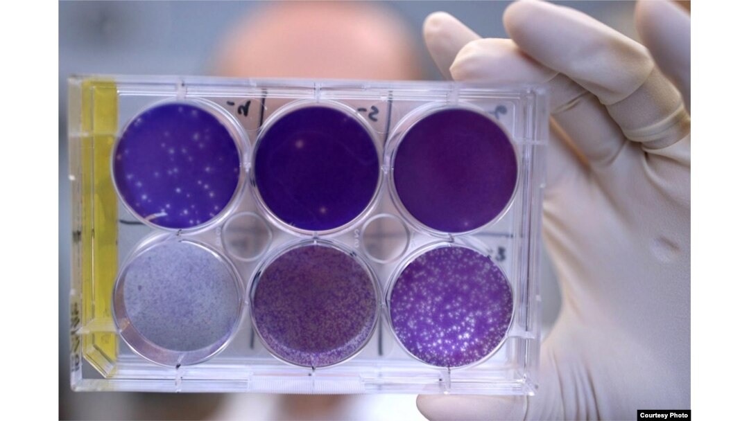 A researcher holds a tray of Zika virus growing in animal cells at Washington University School of Medicine in St. Louis, Missouri. Researchers have identified a human antibody that prevents, in pregnant mice, the fetus from becoming infected and the placenta from being damaged. The antibody also protects adult mice from Zika disease. (Photo courtesy of Huy Mach)
