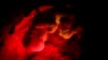 Scientists Grow 13-Day-Old Embryos Outside Womb