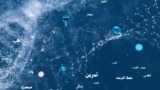 بوعلی سینا: اختلاطات عدم تداوی فیستول های ولادی در زنان