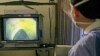 FILE - Colon cancer is one of the world's deadliest diseases, but it often has no symptoms in the early stages.